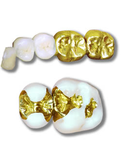em
